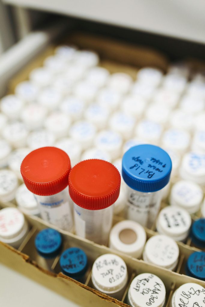 DNA laboratory epigenetic test